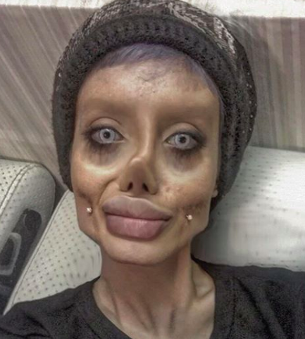Teen dubbed Corpse Bride reportedly had 50 surgeries to look like Angelina Jolie