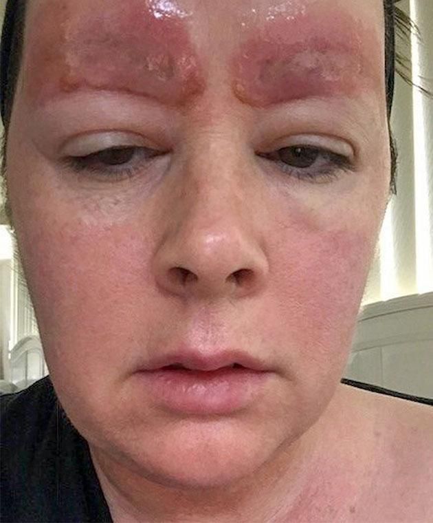 Woman sued after sharing eyebrow tattoo horror