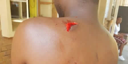S’Africa: Nigerian stabbed, escapes being set ablaze