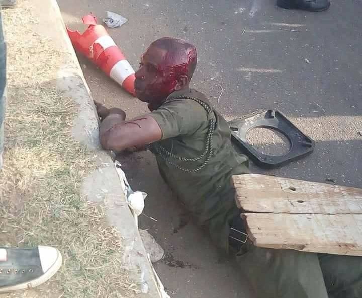 Ekiti guber: Five others shot along with Bamidele -APC