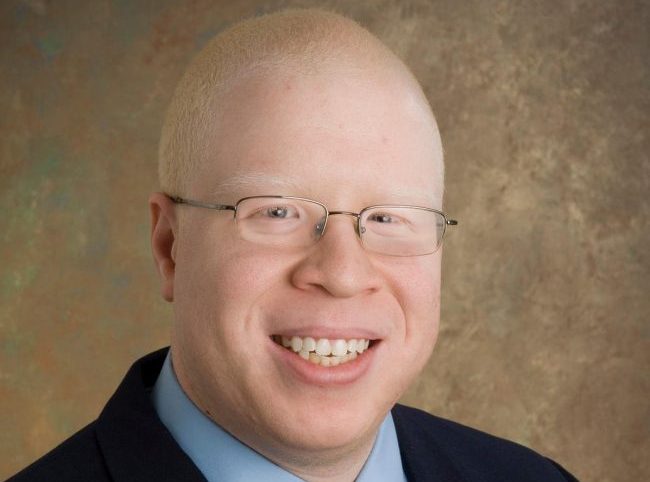 World Albinism Day: Albinos are God’s Creation
