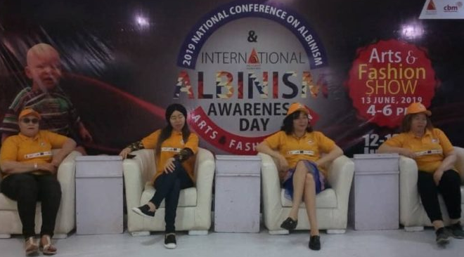International Albinism Awareness Day: Expert Advises on Use of Tinted Glasses