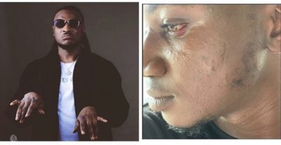 Peruzzi Apologises for Slapping Social Media Influencer Pamilerin