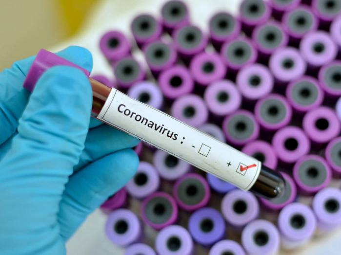 Coronavirus: NCDC Explains Symptoms, Treatment, Advices On Protective Measures