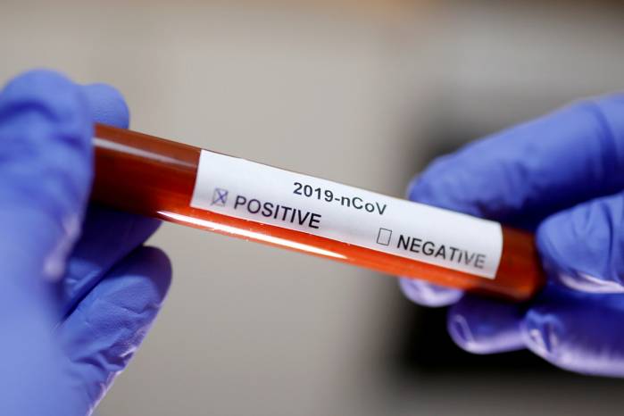 Nigeria’s Coronavirus Cases Soar, As 14 New Cases Are Recorded