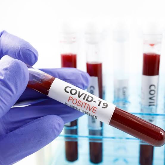 COVID-19: Donations Surpass N697m In One Month