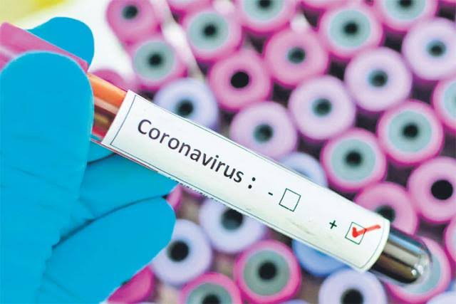 3,912 Nigerians Infected With Coronavirus As NCDC Confirms 386 New Cases