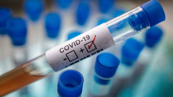 COVID-19: 4 Out Of 11 Travellers From Sokoto Intercepted in Ibadan Test Positive