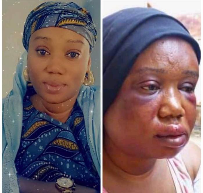 Adamawa Journalist Brutalised By Husband, NUJ Demands Justice