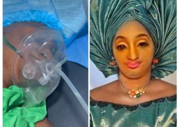 Social Media Actress, Aunty Ramota Allegedly In Coma After “Failed BBL”
