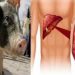 Pig’s Liver Transplanted To Human For First Time