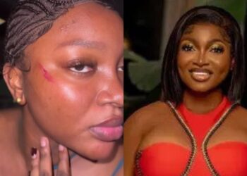 Papaya Ex: Lagos Police Clarifies Alleged Assault Claims On Viral Video