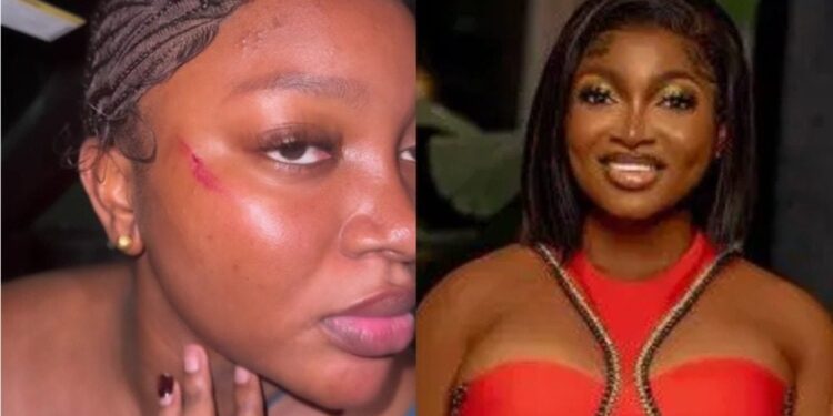 Papaya Ex: Lagos Police Clarifies Alleged Assault Claims On Viral Video