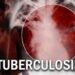 FG Earmarks N73.4b For TB Drugs, Others