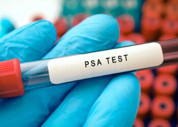 Prostate Cancer: Experts Urge Men Above 45 To Embrace PSA Screening