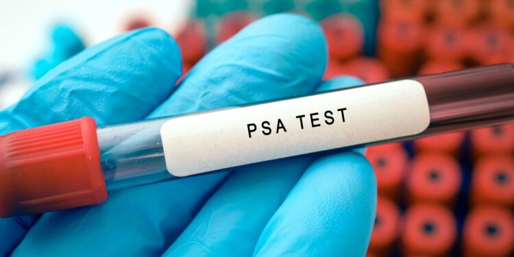 Prostate Cancer: Experts Urge Men Above 45 To Embrace PSA Screening